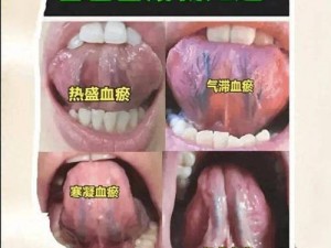 舌推是什么意思_舌推是什么意思？