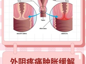 为什么私密部位会红肿疼痛且小缝不能合拢？如何缓解这种症状？