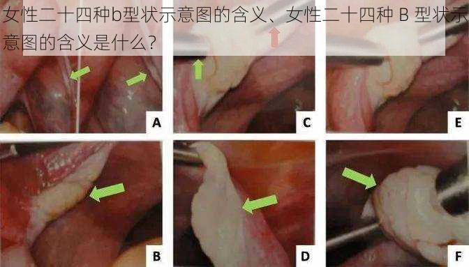 女性二十四种b型状示意图的含义、女性二十四种 B 型状示意图的含义是什么？