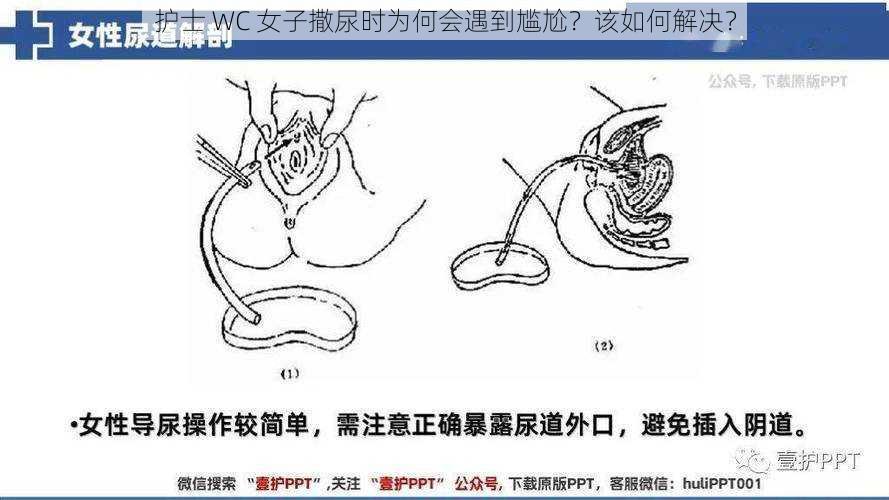 护士 WC 女子撒尿时为何会遇到尴尬？该如何解决？